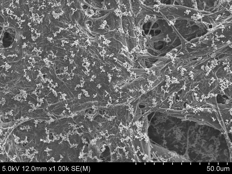 Silver nanoparticle distribution on P-SERS substrates