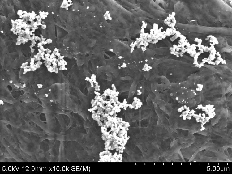 Distribuzione di nanoparticelle d&apos;argento su substrati P-SERS. 