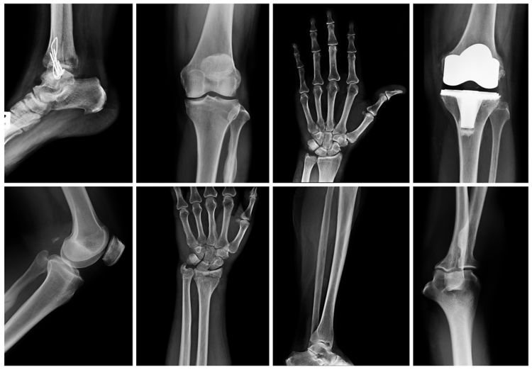 Collage of many X-rays of joints.