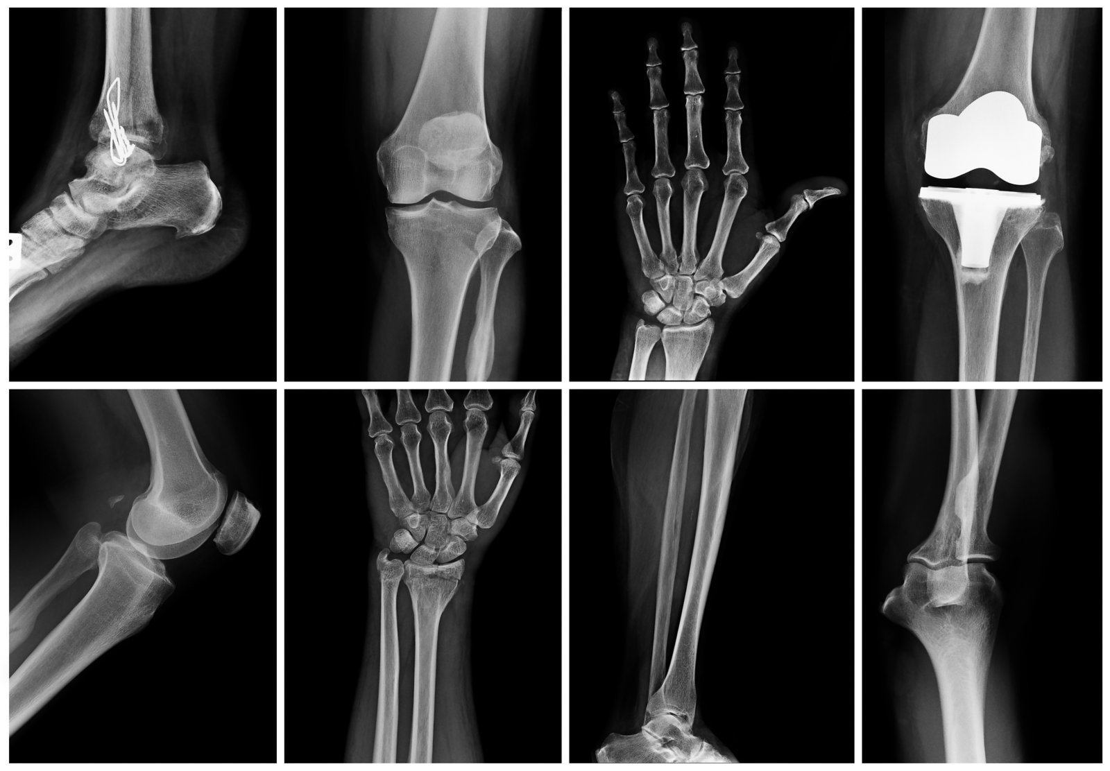 Collage of many X-rays of joints.