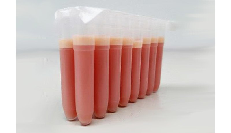 bactrac microbiologia rapida