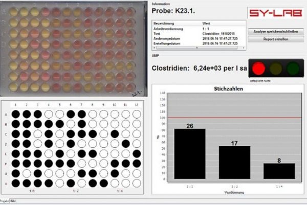 Automated Reading of Results