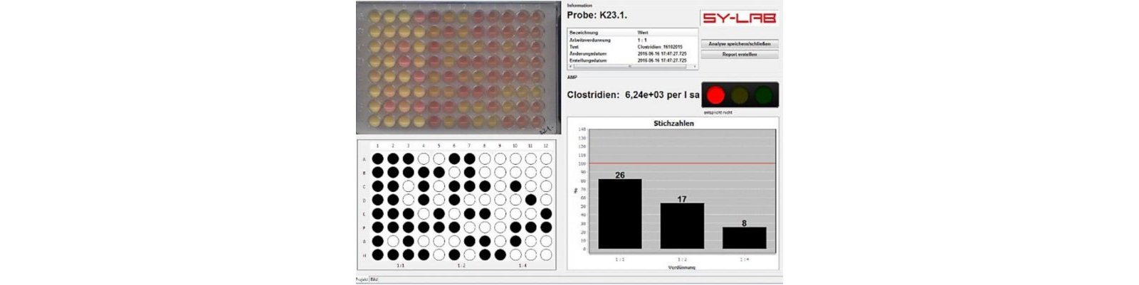 Automated Reading of Results