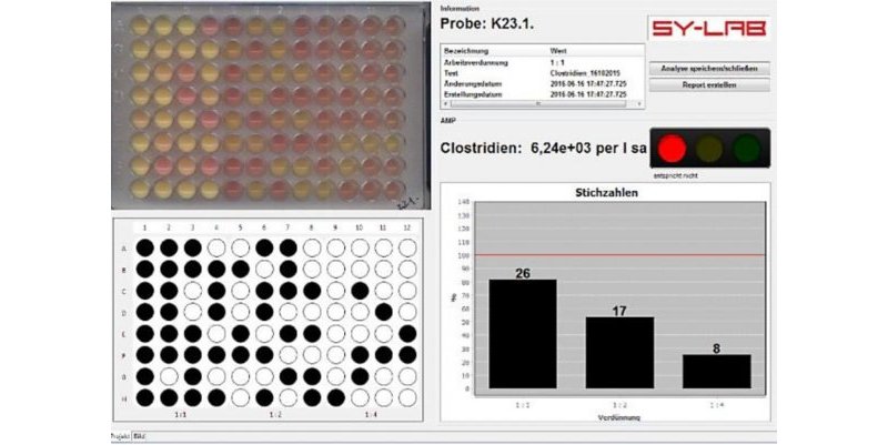 Automated Reading of Results