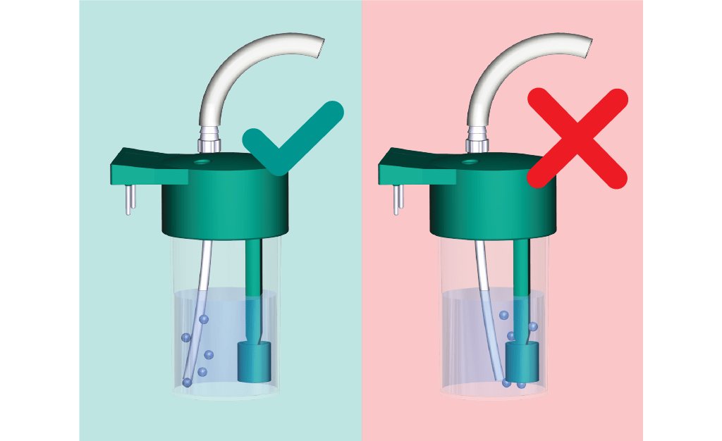 https://metrohm.scene7.com/is/image/metrohm/cannula-placement-2?qlt=85&ts=1644314924444&dpr=off