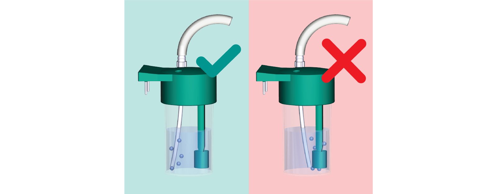https://metrohm.scene7.com/is/image/metrohm/cannula-placement-2?qlt=85&ts=1644314924444&dpr=off