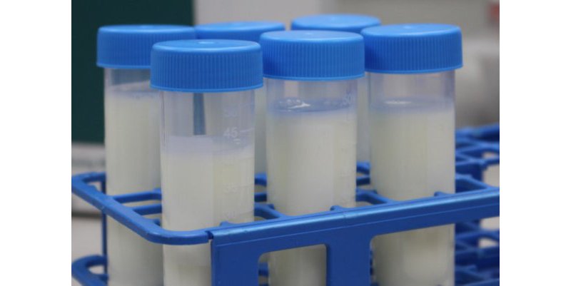 Milk Samples