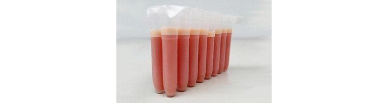 bactrac microbiologia rapida